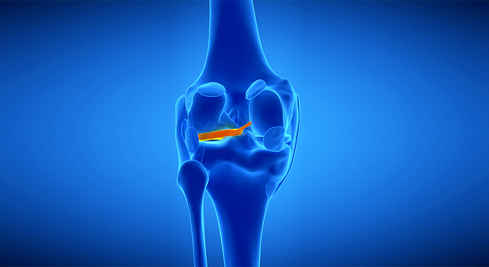 Ligamento Colateral Lateral